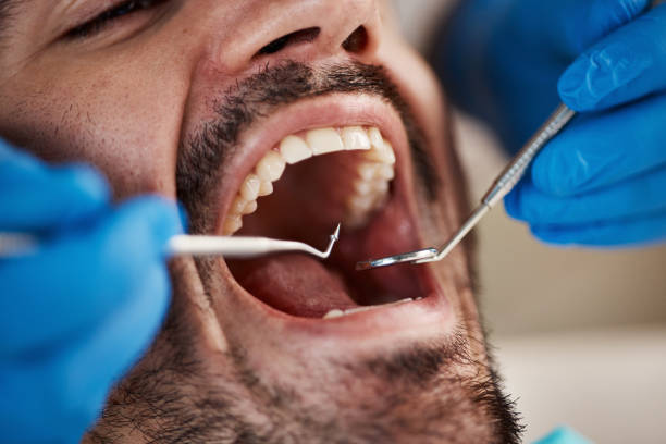 Best Root Canal Treatment  in Woodsfield, OH